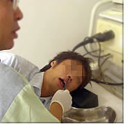 経鼻内視鏡　（鼻からの胃カメラ）